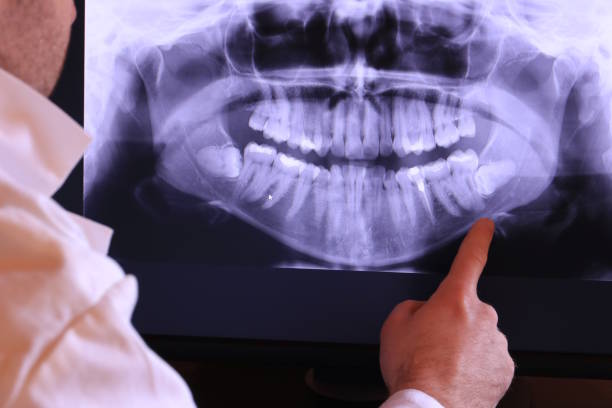 Best Pediatric Emergency Dentist in South Bay, FL