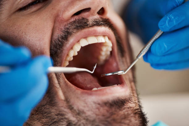 Best Emergency Orthodontic Repairs in South Bay, FL