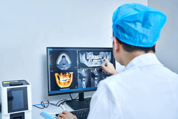 Best Emergency Tooth Extraction in South Bay, FL